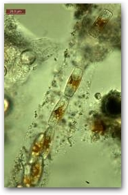 Фрагмент трубчатой колонии диатомеи из рода энционема (Encyonema).