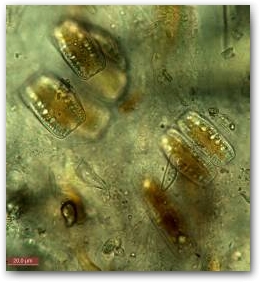 Клетки диатомей из рода эпитемия (Epithemia) на поверхности полимерных капсул мастоглоиа (Mastogloia).