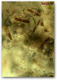 Фрагмент биоплёнки, содержащий клетки диатомеи из рода дентикула (Denticula).