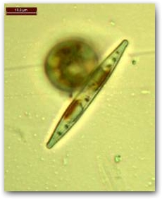 Клетка подвижной диатомеи из рода ницшия (Nitzschia) (на переднем плане).
