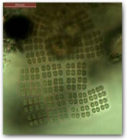 Пластинчатые однослойные колонии цианобактерии из рода мерисмопедия (Merismopedia).