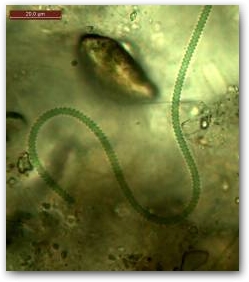 Спирально завитой трихом цианобактерии из рода спирулина (Spirulina) движется среди детрита внутри биоплёнки.