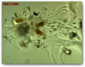 Нити (трихомы) цианобактерий из рода калётрикс (Calothrix), одетые в многослойные прозрачные чехлы.