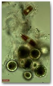 Небольшая “гроздь” коккоидных клеток динофлагелляты хемидиниум (Hemidinium)(в нижней части снимка). В верхней части фрагмент древовидной колонии мастоглои (Mastogloia).