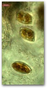 Фрагмент колонии мастоглоиа (Mastogloia), клетки одеты в капсулы.