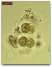 Микроколония цианобактерии из рода хроококкус (Chroococcus).