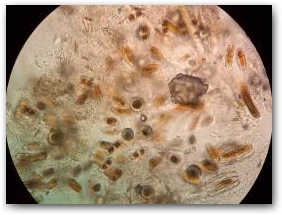 Фрагмент биоплёнки, сотканной древовидными колониями из клеток мастоглой (Mastogloia), одетых в прозрачные полимерные капсулы. Каменистое мелководье озера Иссык-Куль в районе пос. Чолпон-Ата.