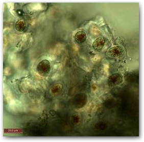 Фрагмент пальмеллевидной (погружённой в общий матрикс) колонии одного из видов  коккоидных динофлагеллят (предположительно глеодиниум - Gloeodinium), обильно развивающегося в нижних слоях биоплёнки.