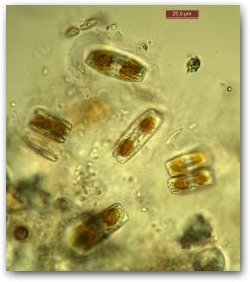 Клетки диатомей из рода мастоглоиа (Mastogloia), одетые в многослойные прозрачные капсулы, формирующиеся из выделяемых ими экзополимеров. Между капсулами видны группы эллиптических светло-зеленых клеток - колонии цианобактерий из рода афанотеке  (Aphanothece) в прозрачном полисахаридном матриксе.