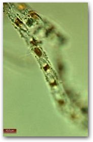 Фрагмент трубчатой колонии диатомеи из рода навикула (Navicula).