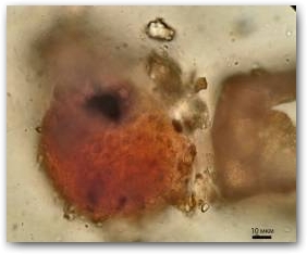 Колония цианобактерий Gloeocapsa sanguinea, одетая в многослойную багряно-розовую капсулу.