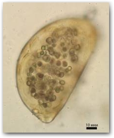 Молодая колония цианобактерий Nostoc commune, видна нить цианобактерий, извивающаяся петлями.