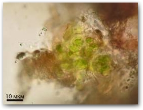 Фрагмент небольшой ветви зелёной микроводоросли Desmococcus olivaceus