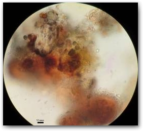 Фрагмент биоплёнки с микроколониями разных видов цианобактерий.