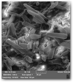 Клетки диатомей из рода Gomphonema на поверхности кораллоподобной структуры, снято с помощью СЭМ Нажмите, чтобы увеличить