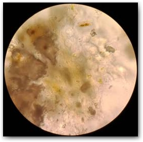 В правой части снимка, сделанного при большом увеличении с помощью светового микроскопа (СМ), видны колонии зеленой микроводоросли Chormotila, в левой части - нарастающие агломерации микрокристаллов кальцитов Нажмите, чтобы увеличить