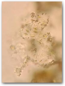 Микроколония диатомей из рода Achnanthidium, клетки которых погружены в прозрачный биополимерный матрикс Нажмите, чтобы увеличить