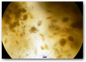 Фрагмент верхнего слоя корки, видны капсулы мастоглой и цепочки микрокристаллов по краям снимка