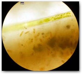 21 Верхний слой корки: видны цепочки микрокристаллов кальцитов, переплетения трихомов цианобактерий, россыпь мастоглой в капсулах и – сверху – нитчатая зелёная водоросль из рода Mougeotia